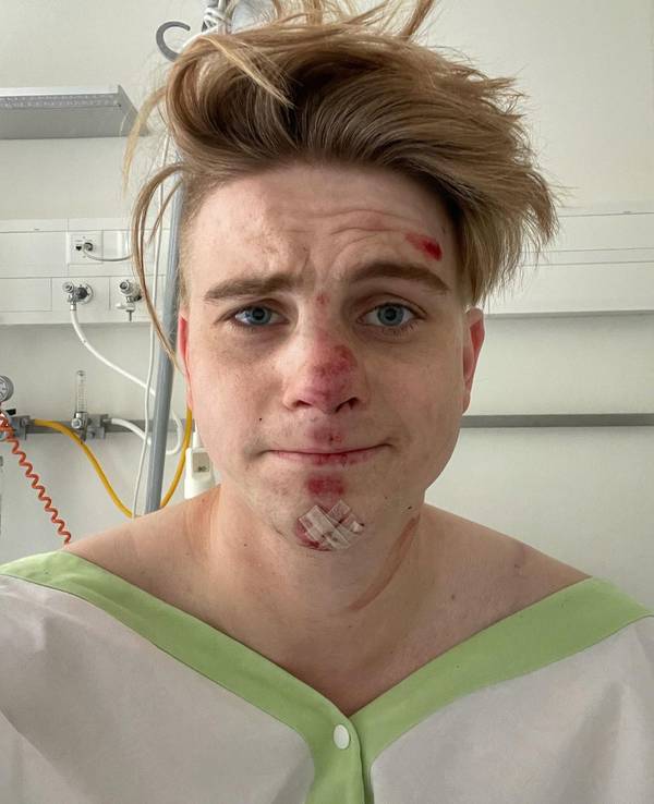 Vincent Gross im Krankenhaus mit Schürfwunden im Gesicht