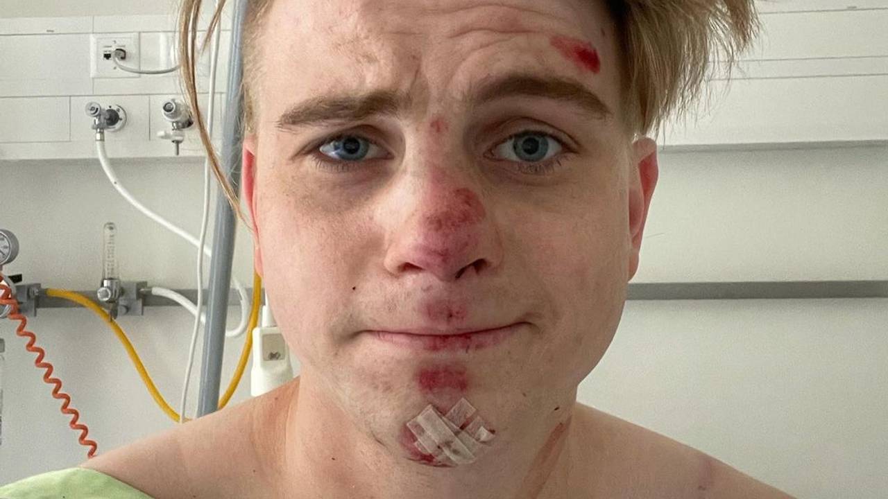Vincent Gross im Krankenhaus mit Schürfwunden im Gesicht