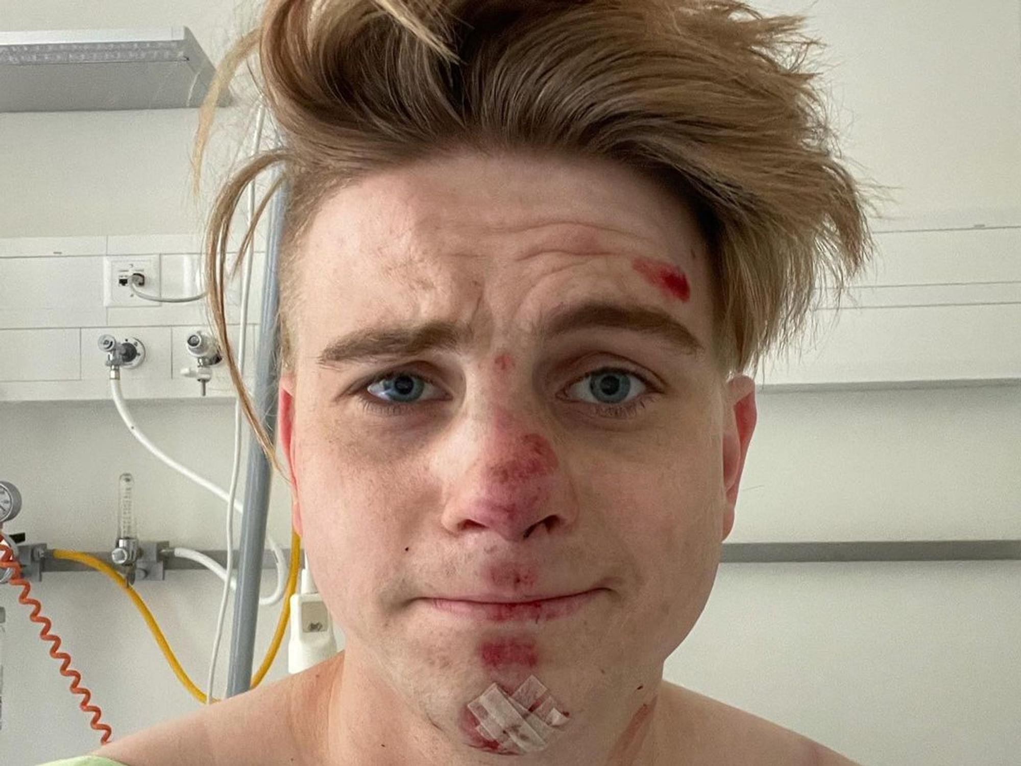 Vincent Gross im Krankenhaus mit Schürfwunden im Gesicht