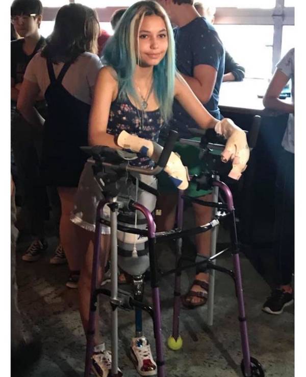 Die US-Amerikanerin Paige Winter läuft mit einer Gehhilfe, ihre Hände sind bandagiert, sie trägt eine Beinprothese, aber sie lächelt.