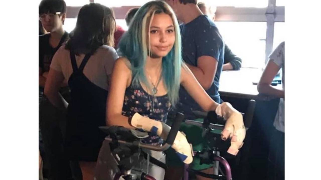 Die US-Amerikanerin Paige Winter läuft mit einer Gehhilfe, ihre Hände sind bandagiert, sie trägt eine Beinprothese, aber sie lächelt.