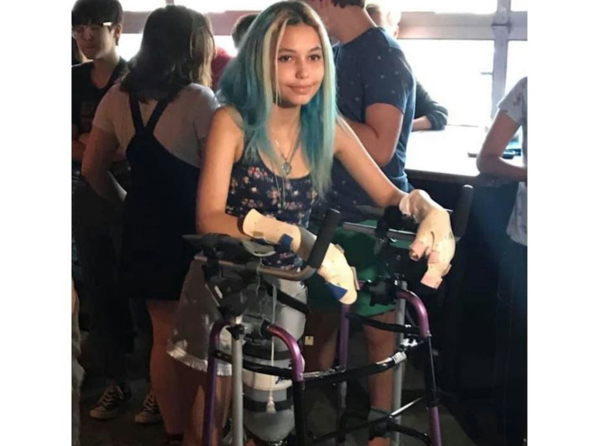 Die US-Amerikanerin Paige Winter läuft mit einer Gehhilfe, ihre Hände sind bandagiert, sie trägt eine Beinprothese, aber sie lächelt.