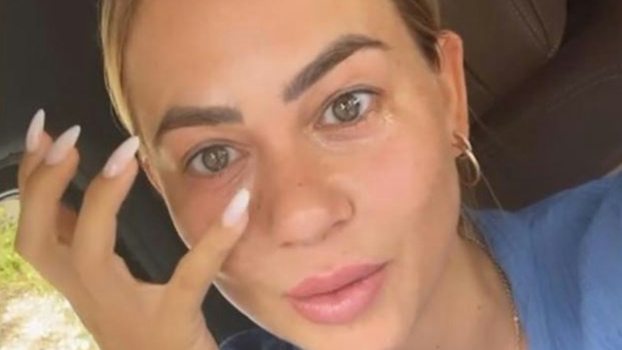 Jessica Paszka sitz im Auto und zeigt auf ihre Augenerkrankung.