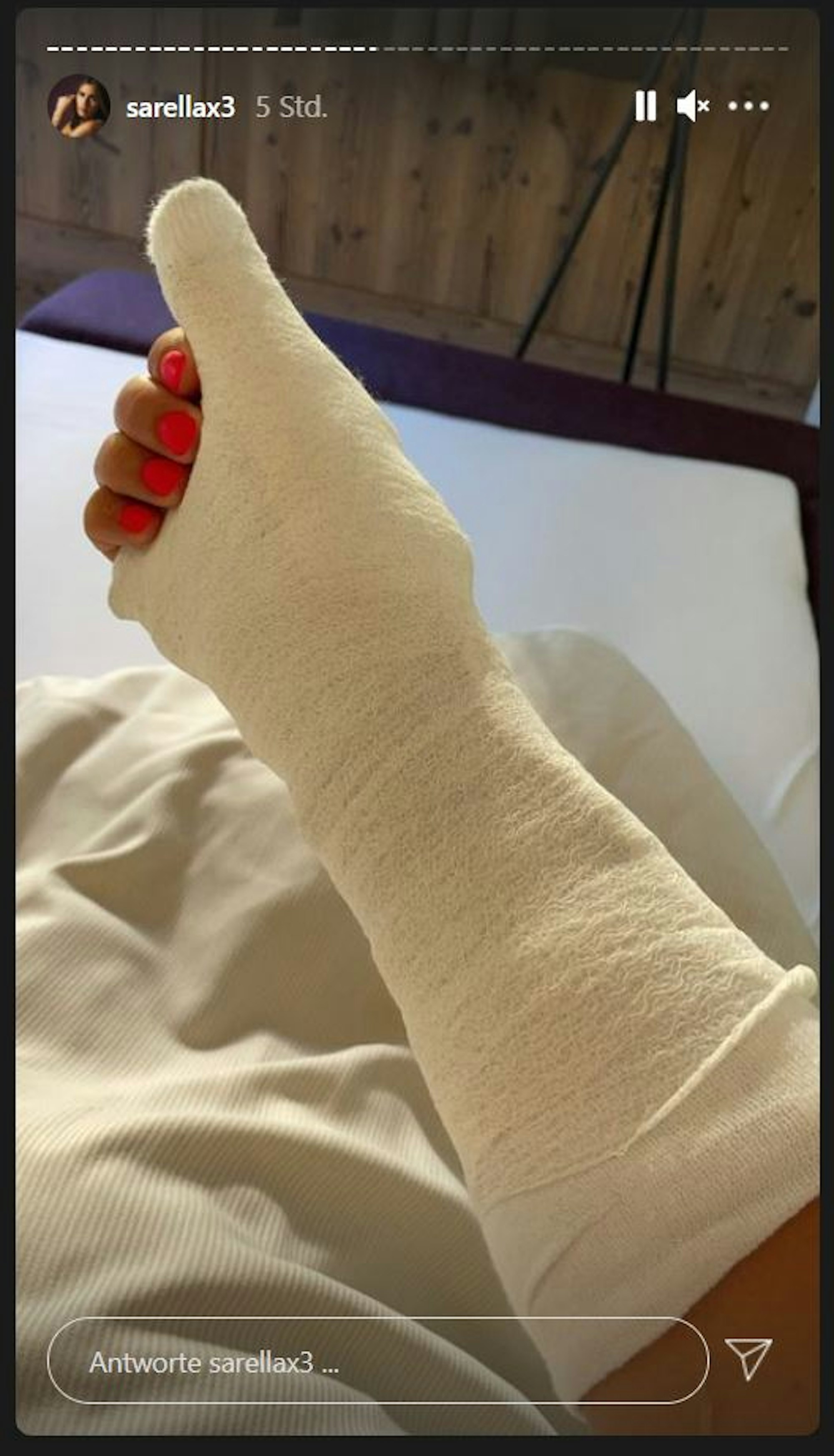 Sarah Engels hat sich im Uralub in Tirol das Kahnbein gebrochen. In ihrer Instagram-Story vom 29.7.2021 zeigt die Sängeirn ihren eingegipsten rechten Arm.