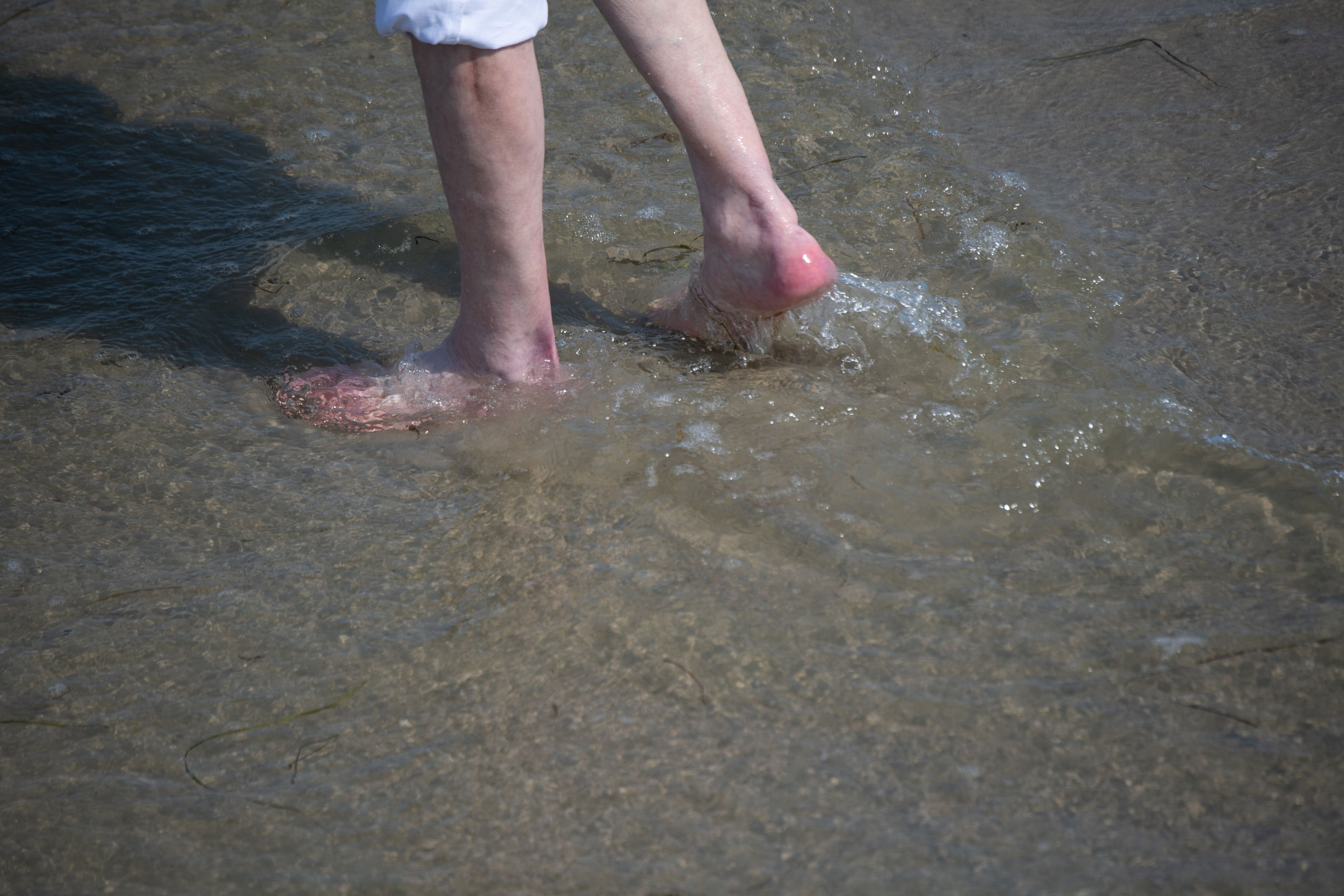 In Ostholstein (Schleswig-Holstein) ist eine Frau an den Folgen einer Vibrionen-Infektion gestorben. Offenbar war sie trotz offener Wunde in der Ostsee baden. Auf dem Foto sieht man einen Mann durch flaches Gewässer am Ostsee-Strand waten.