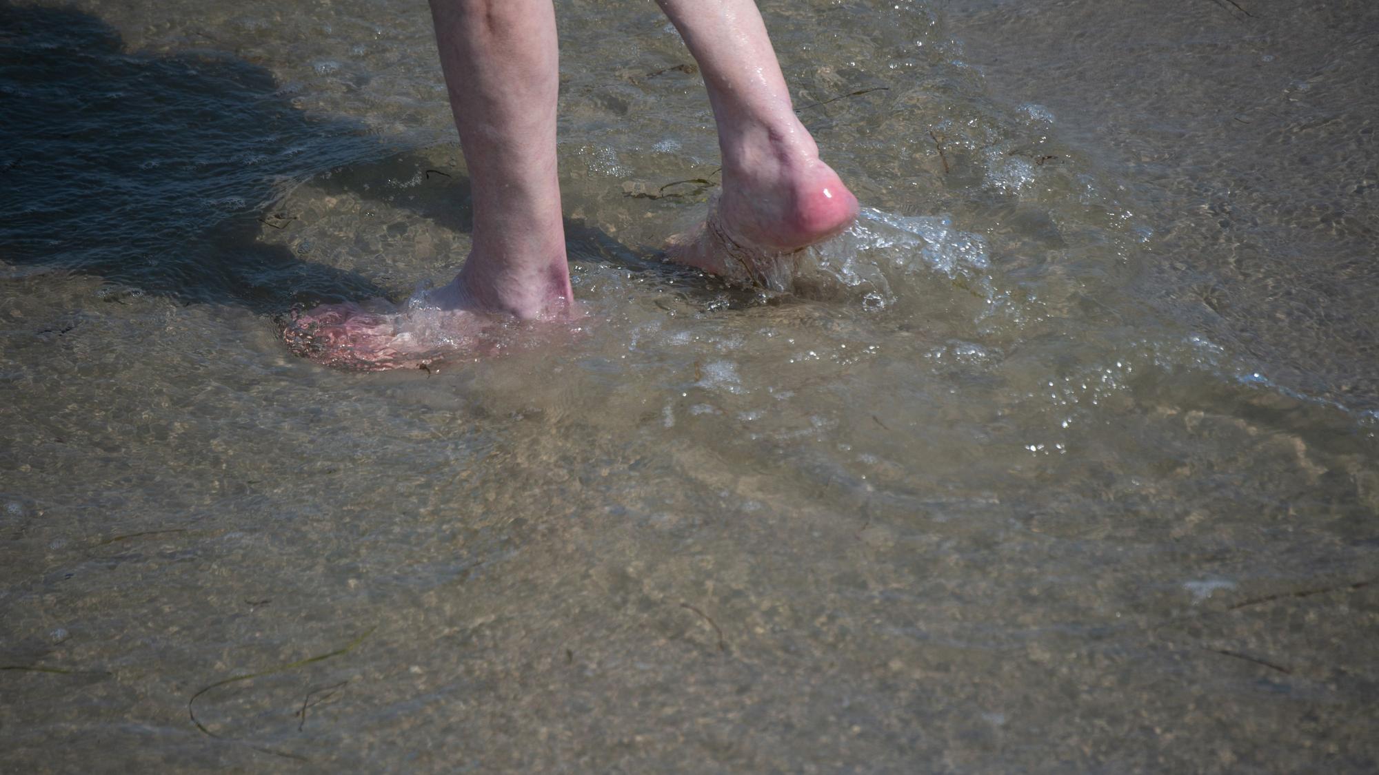 In Ostholstein (Schleswig-Holstein) ist eine Frau an den Folgen einer Vibrionen-Infektion gestorben. Offenbar war sie trotz offener Wunde in der Ostsee baden. Auf dem Foto sieht man einen Mann durch flaches Gewässer am Ostsee-Strand waten.