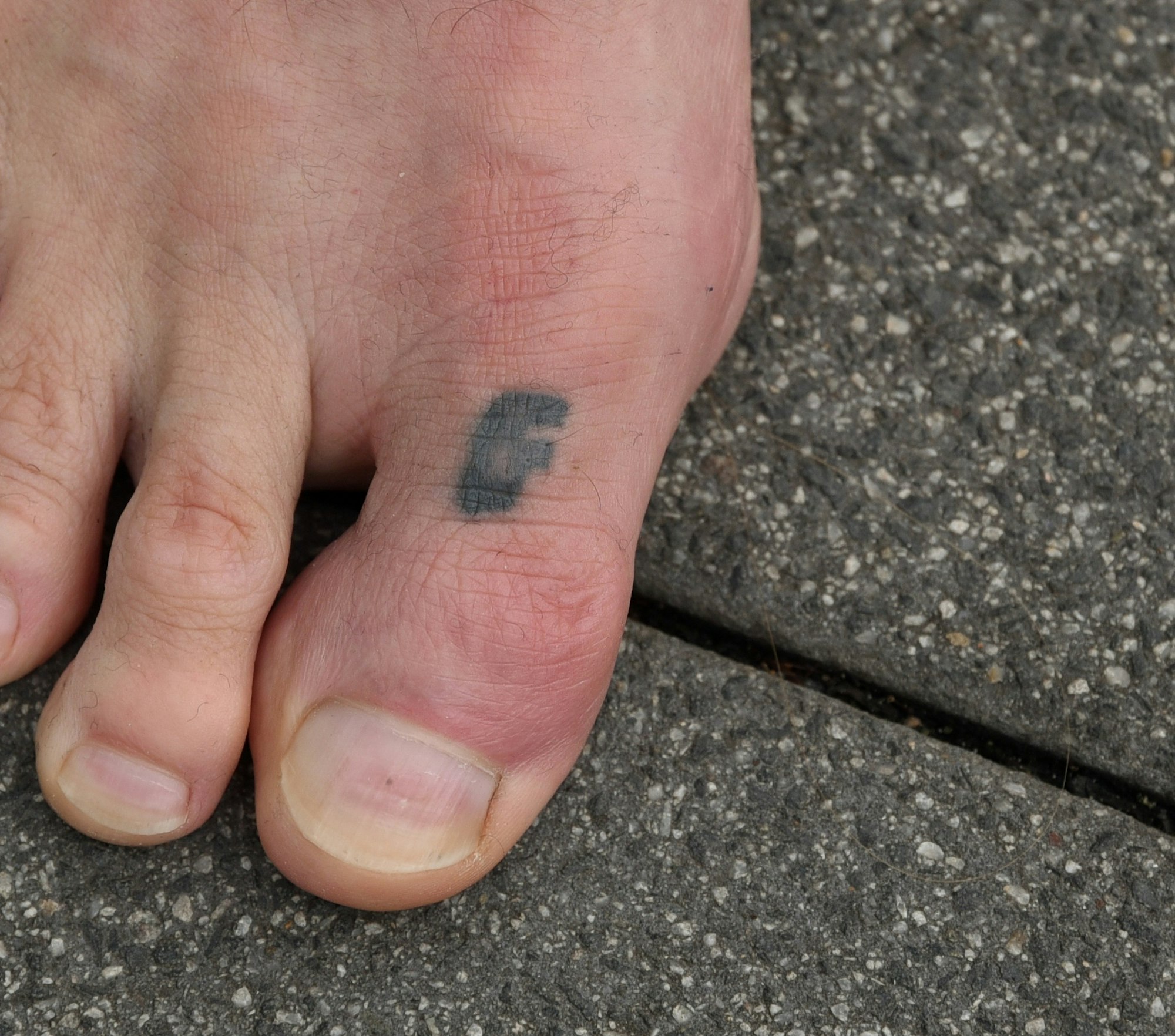 Das FC-Tattoo auf dem Zeh von Toni Schumacher.