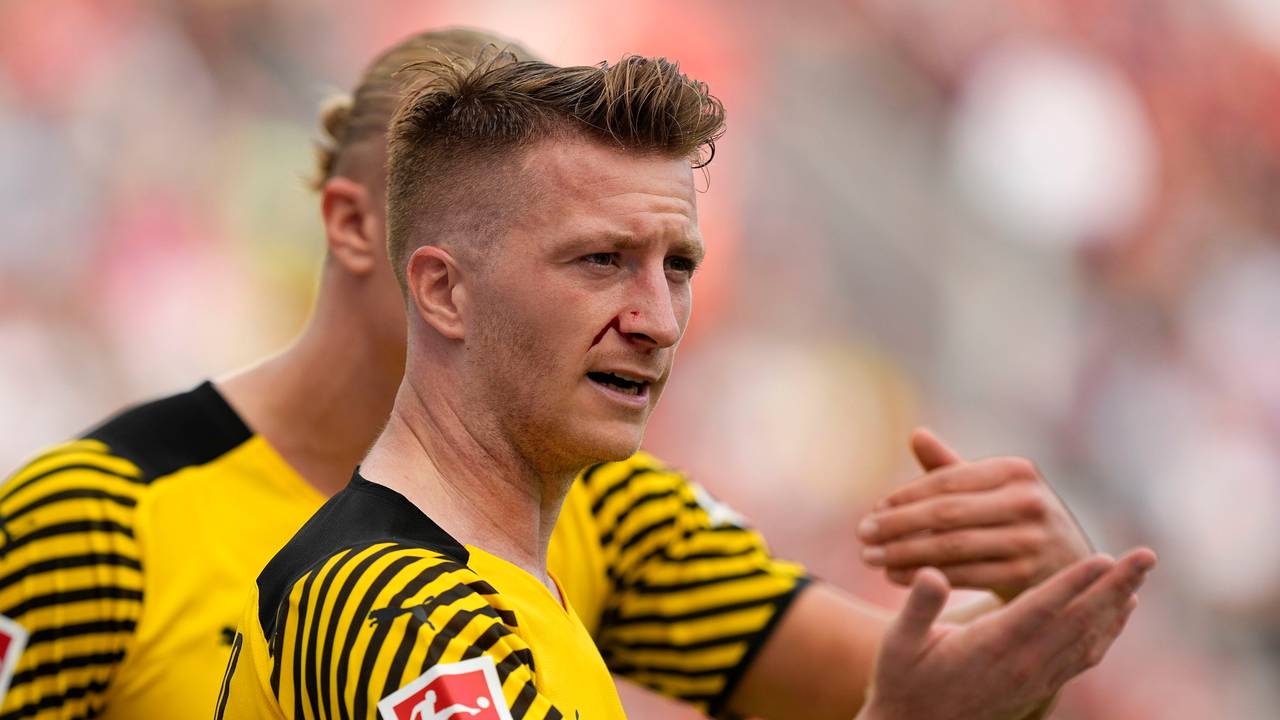 Dortmunds Marco Reus mit Gesichtsverletzung beim Spiel gegen Leverkusen.