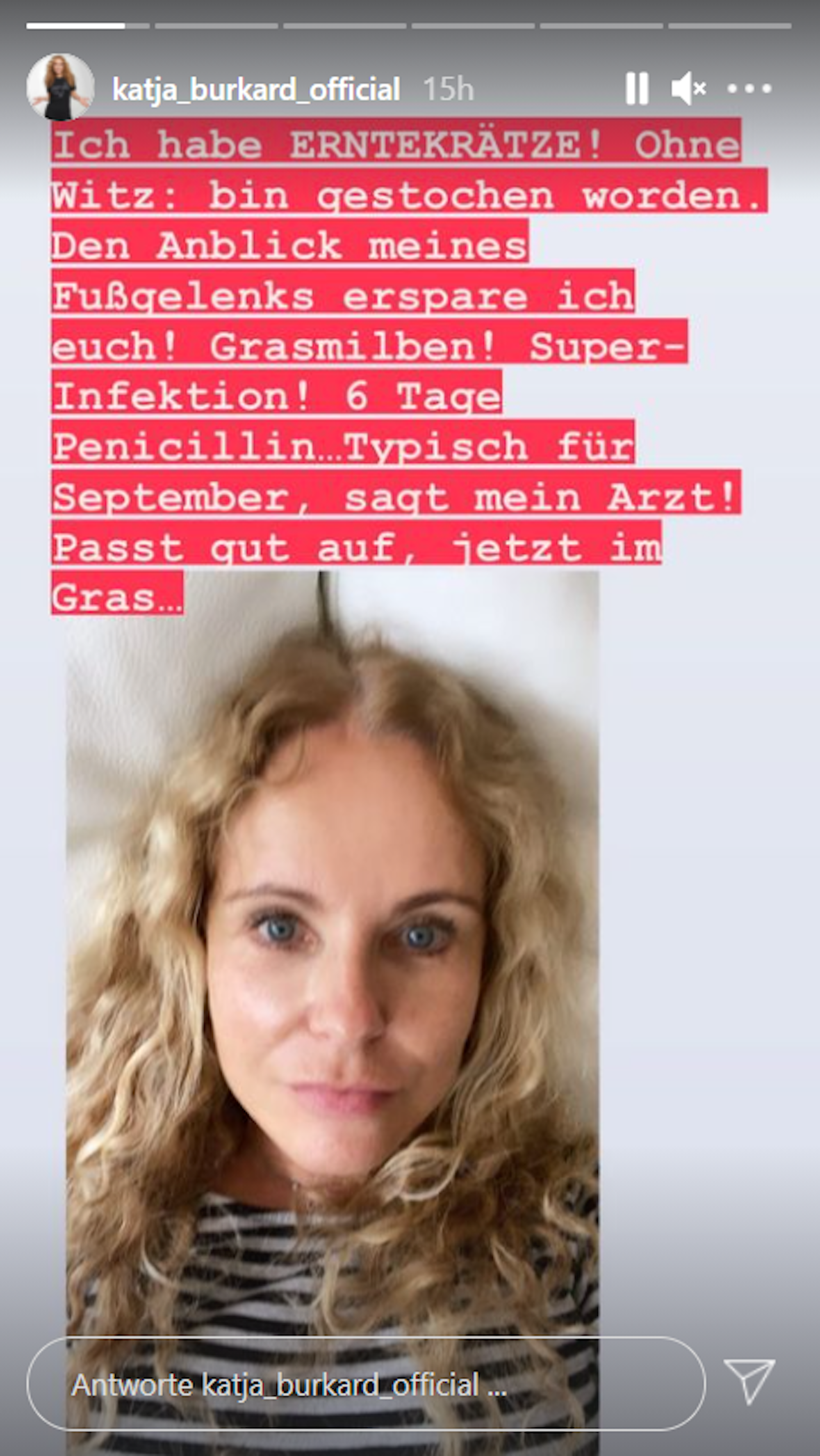 In ihrer Instagram-Story warnt die Moderatorin ihre Follower vor den beißenden Milben.