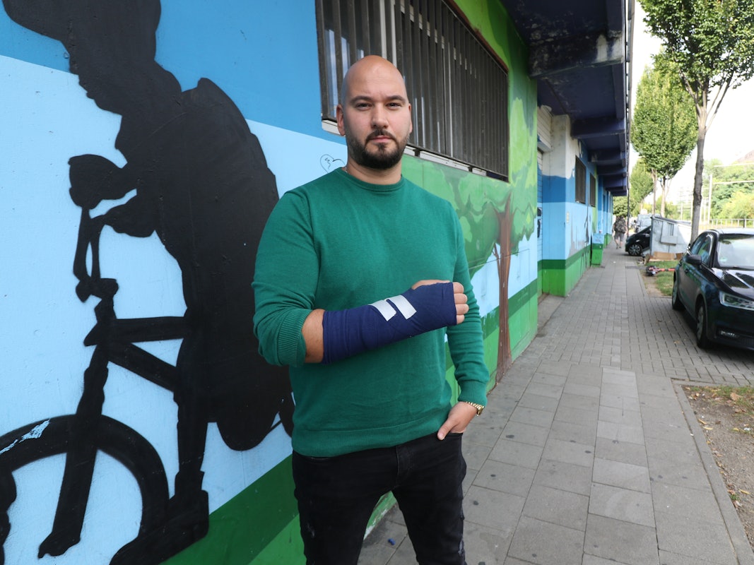 Der Kölner Murat K. (40) zeigt seinen Arm, an den ein Gips angebracht wurde.