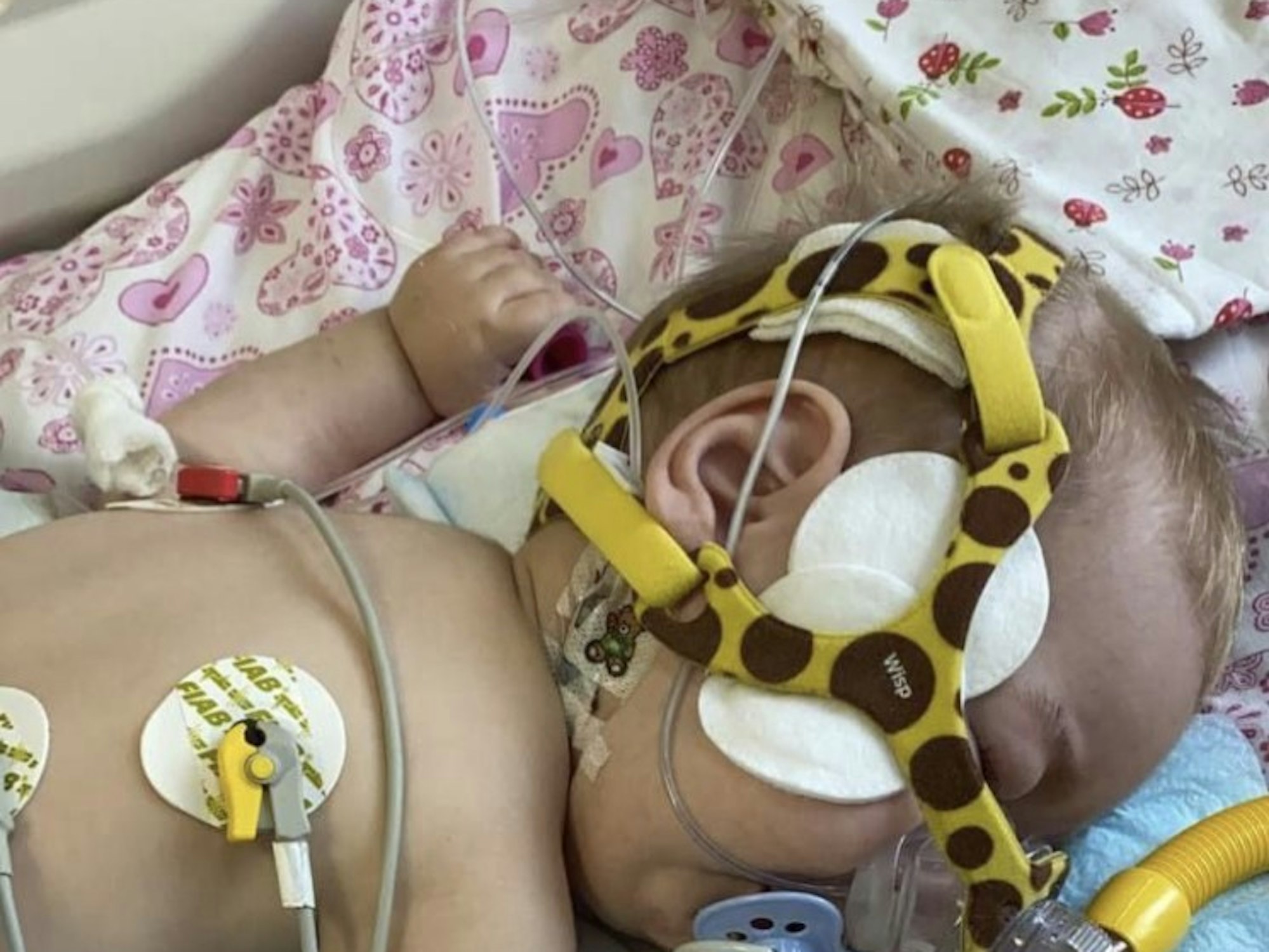 Timur hat eine seltene Krankheit und kann ohne Spendenhilfe nicht überleben.