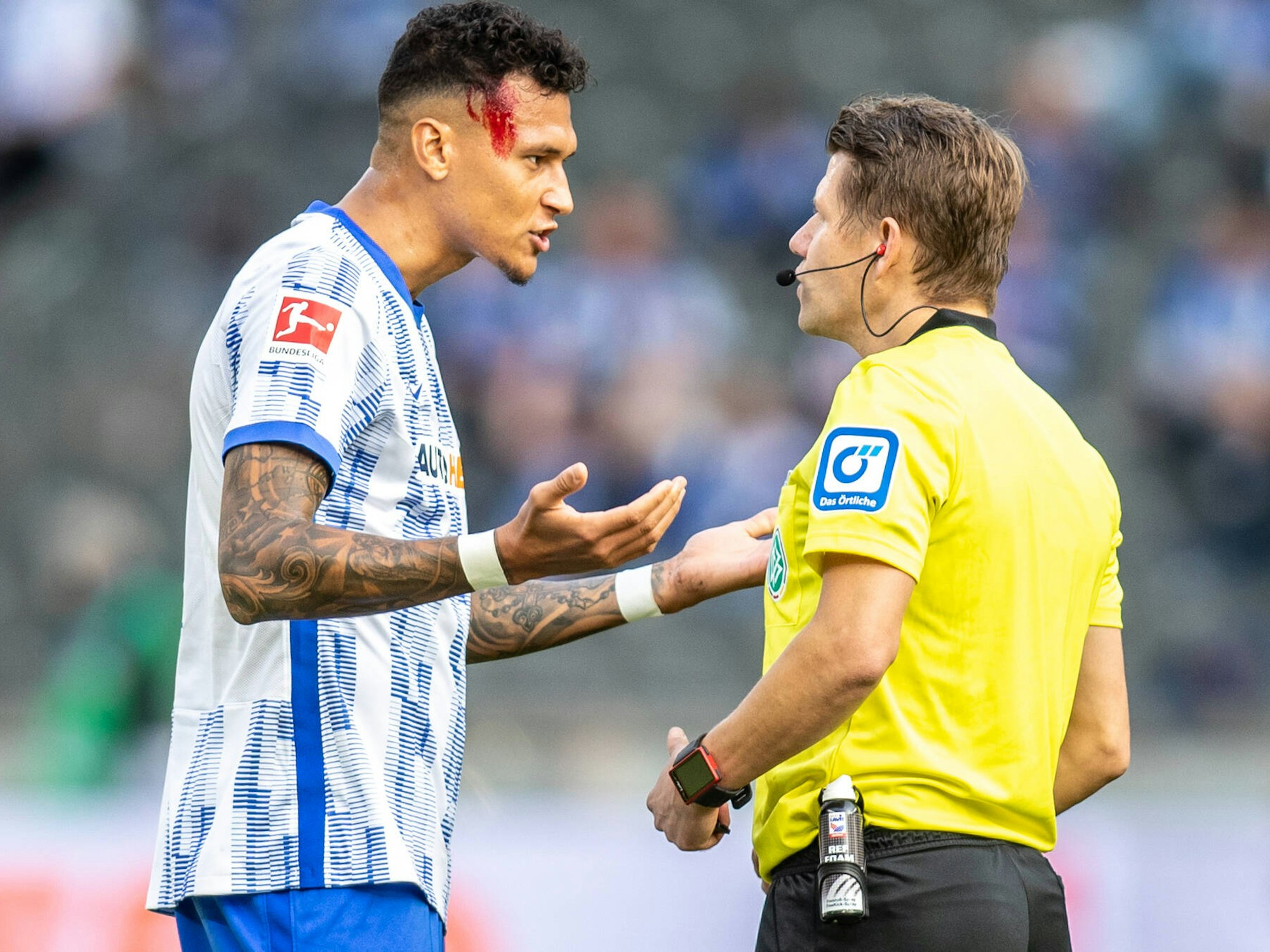Davie Selke blutet beim Bundesliga-Spiel Hertha BSC gegen SC Freiburg.