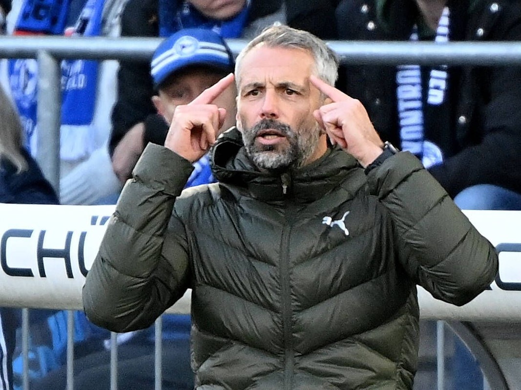 Marco Rose deutet mit beiden Zeigefingern auf seine Schläfen.