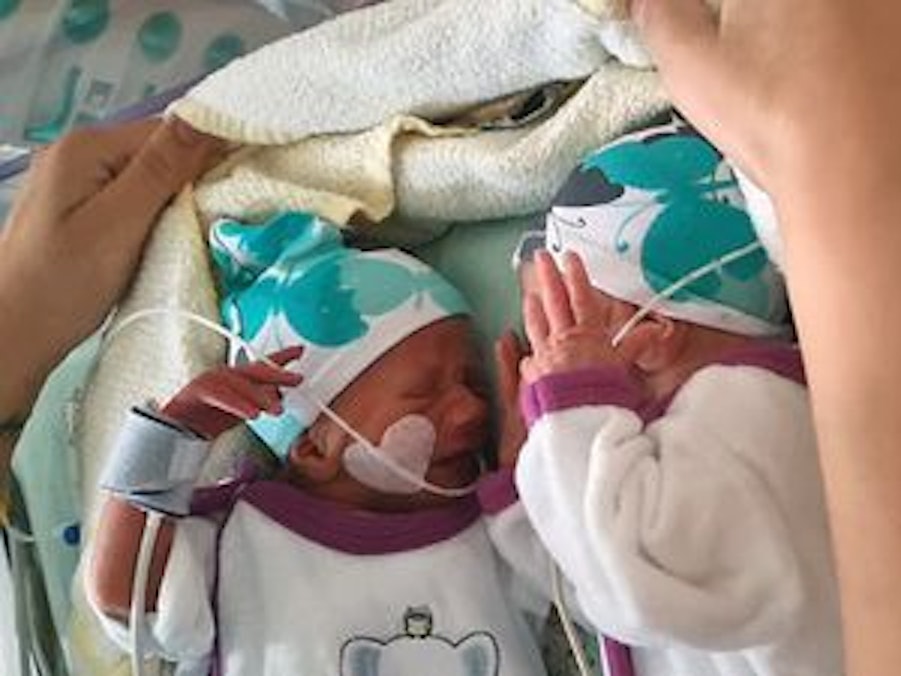 So klein und schon so viel Drama. Die Geburt der Wollny-Zwillinge Casey und Emory im Mai war um einiges dramatischer, als bisher bekannt.