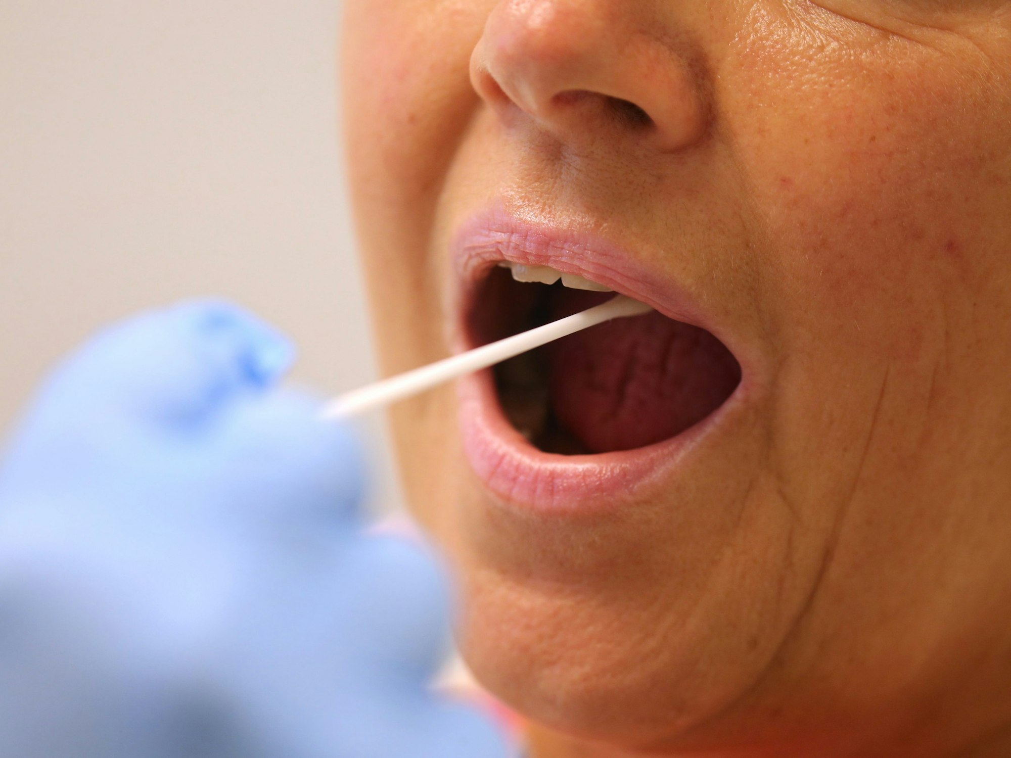 Ein Arzt nimmt in einer Hausarztpraxis mit einem Tupfer einen Abstrich bei einer Frau für einen Corona-Test.