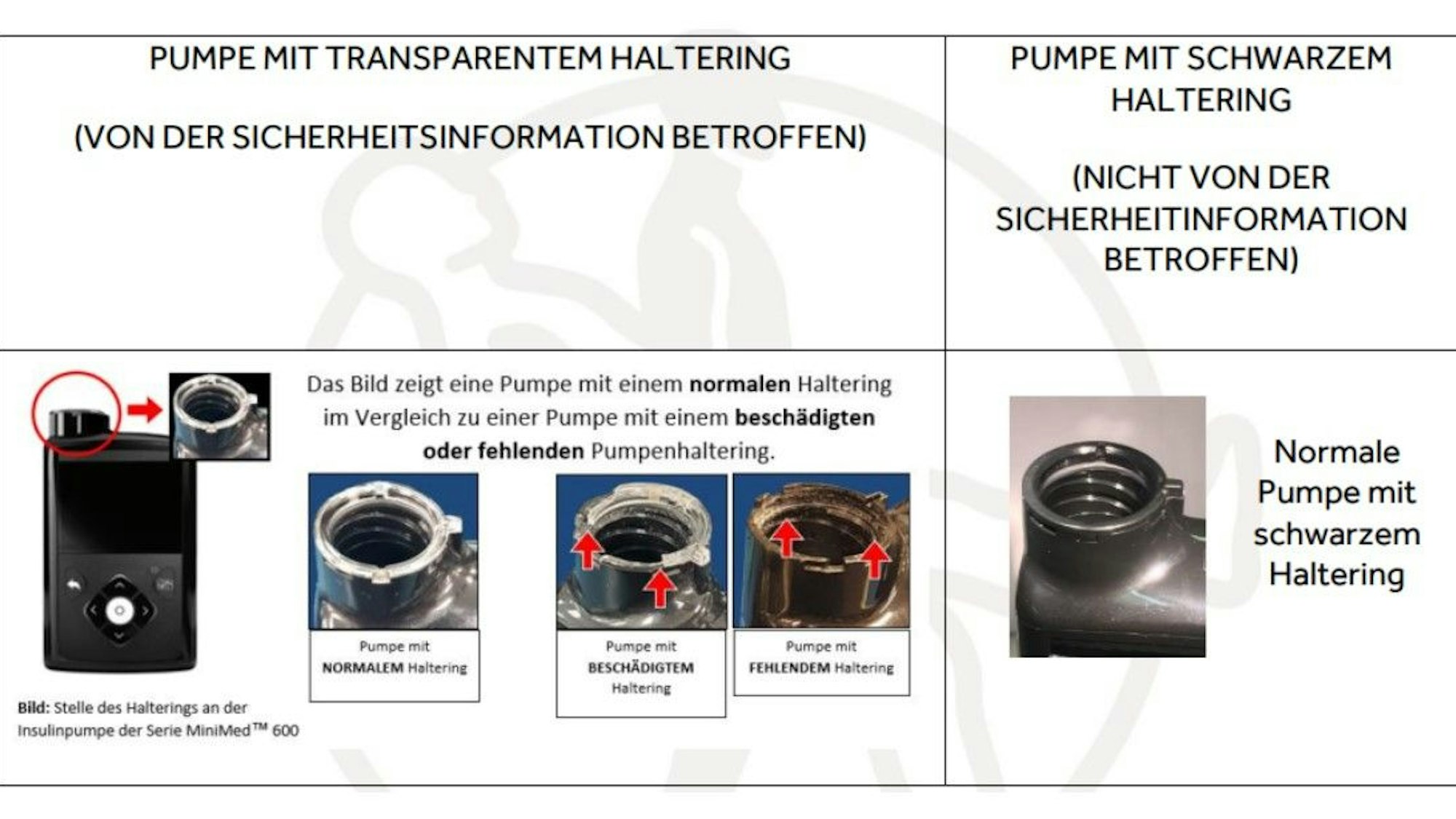 Auf dem Foto sieht man eine Grafik, die Fotos der Pumpe mit transparentem Haltering und der mit schwarzem Haltering vergleicht.