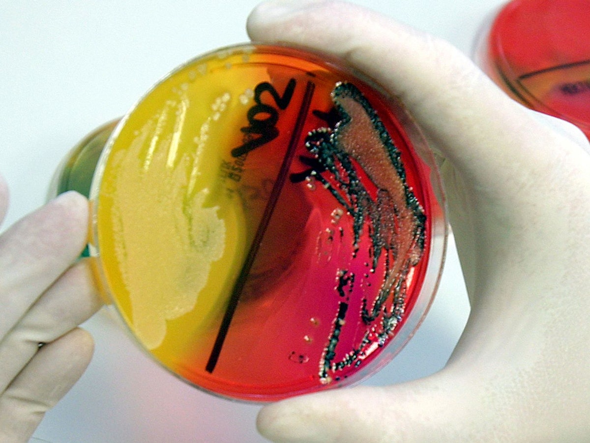 22.05.2007 in Fulda: Eine Labor-Mitarbeiterin zeigt eine Petrischale mit einer Salmonellenkultur.