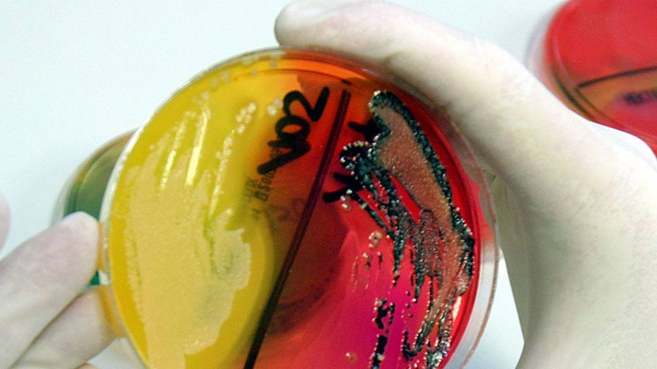 22.05.2007 in Fulda: Eine Labor-Mitarbeiterin zeigt eine Petrischale mit einer Salmonellenkultur.