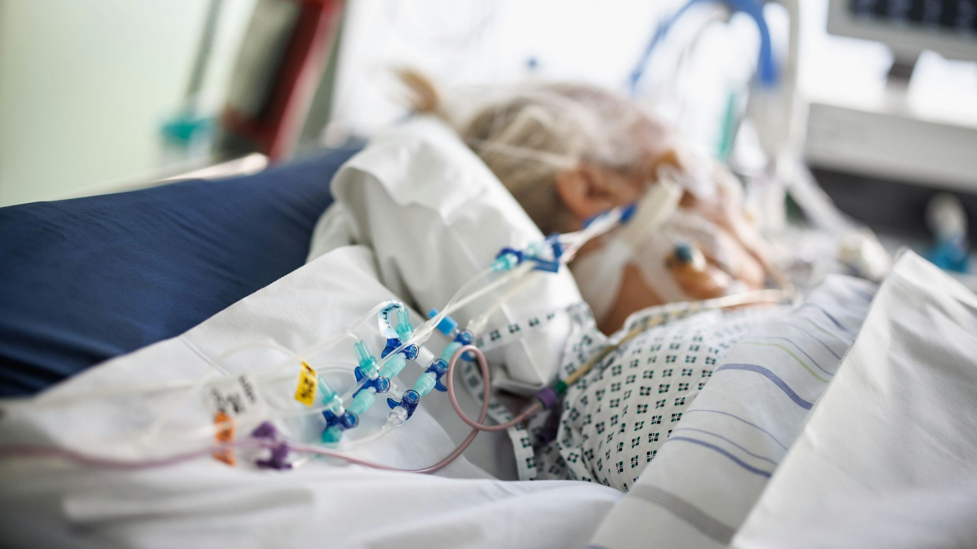 Ein intubierter Corona-Patient in einem Intensivbett-Zimmer der Asklepios Klinik in Gauting (Bayern).