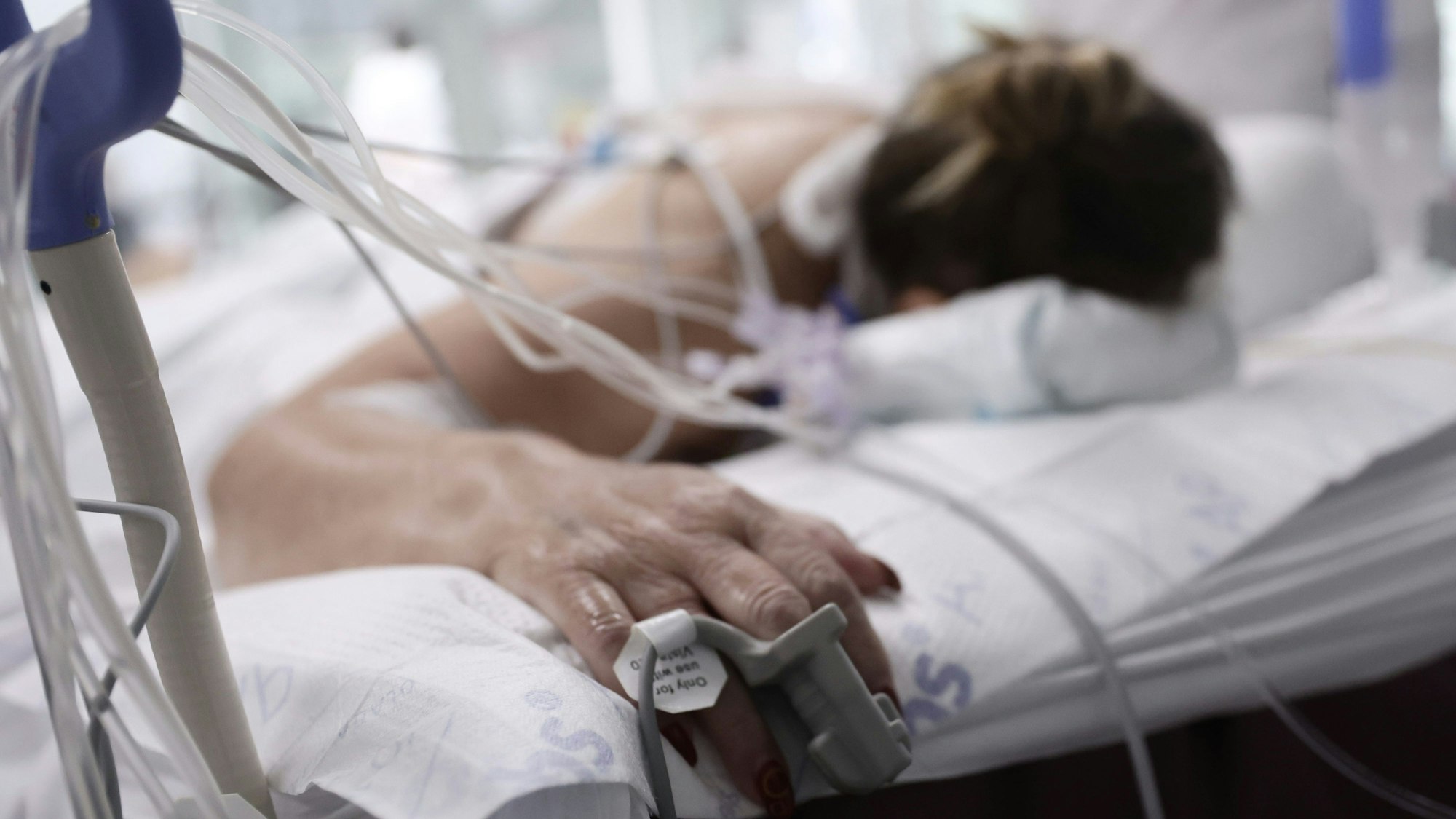Das Symbolfoto (aufgenommen am 23. November 2021 in Madrid) zeigt eine Corona-Patientin, welche im Krankenhaus in ein künstliches Koma versetzt werden musste.