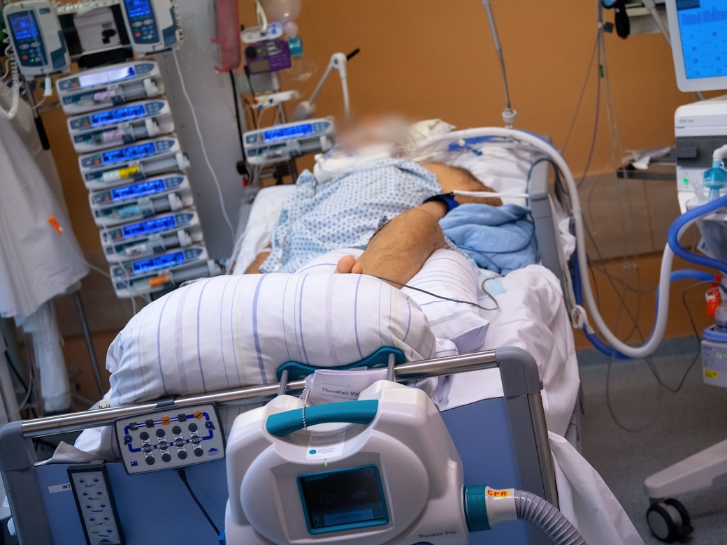 Ein Covid-19 Patient liegt in einem isoliertem Intensivbett-Zimmer in der Asklepios Klinik. Der Patient liegt im künstlichen Koma und wird beatmet.