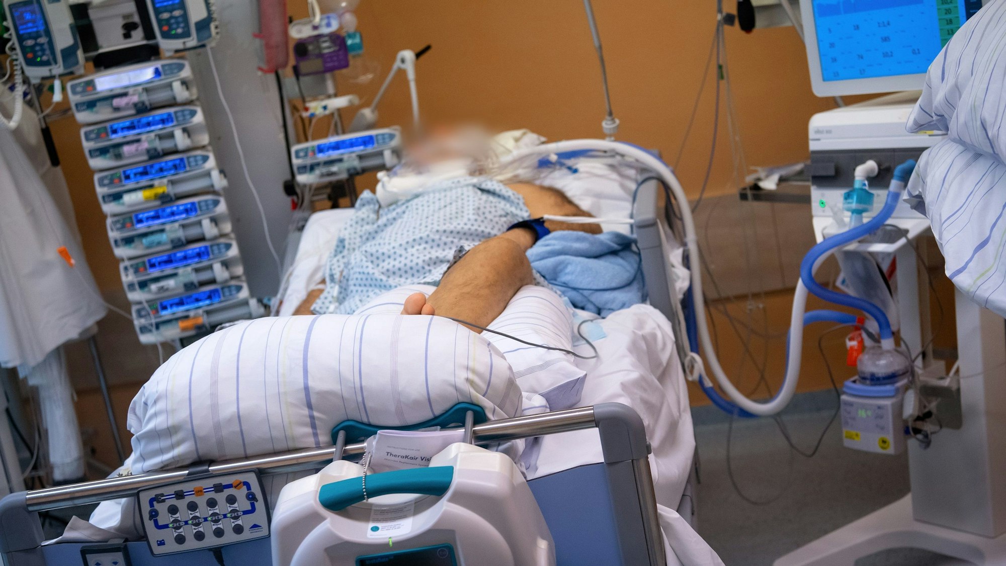 Ein Covid-19 Patient liegt in einem isoliertem Intensivbett-Zimmer in der Asklepios Klinik. Der Patient liegt im künstlichen Koma und wird beatmet.