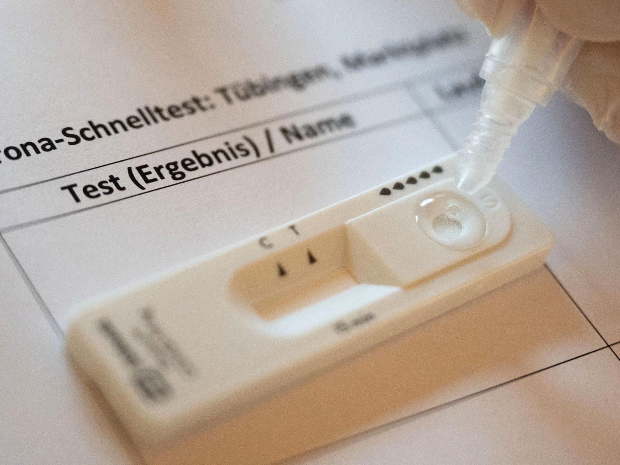 Ein Corona-Test wird in einer Teststation in Tübingen durchgeführt.
