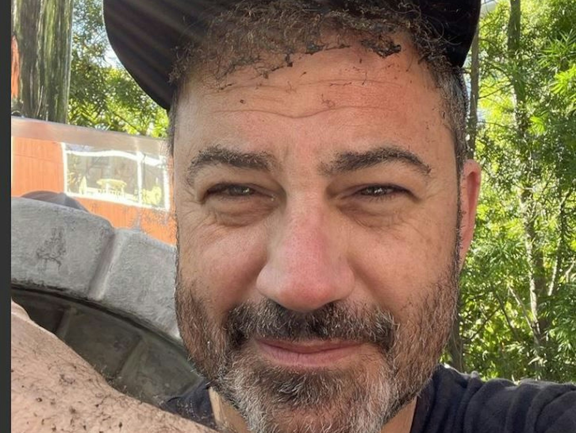 Us-Moderator Jimmy Kimmel hat sich die Haare auf dem Kopf und den Armen verbrannt, wie er auf dem Selfie zeigt.