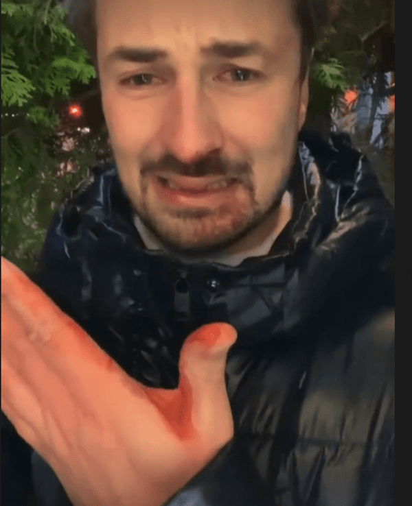 Nicolas Puschmann mit blutverschmiertem Gesicht auf einem Foto vom 2. Dezember 2021.