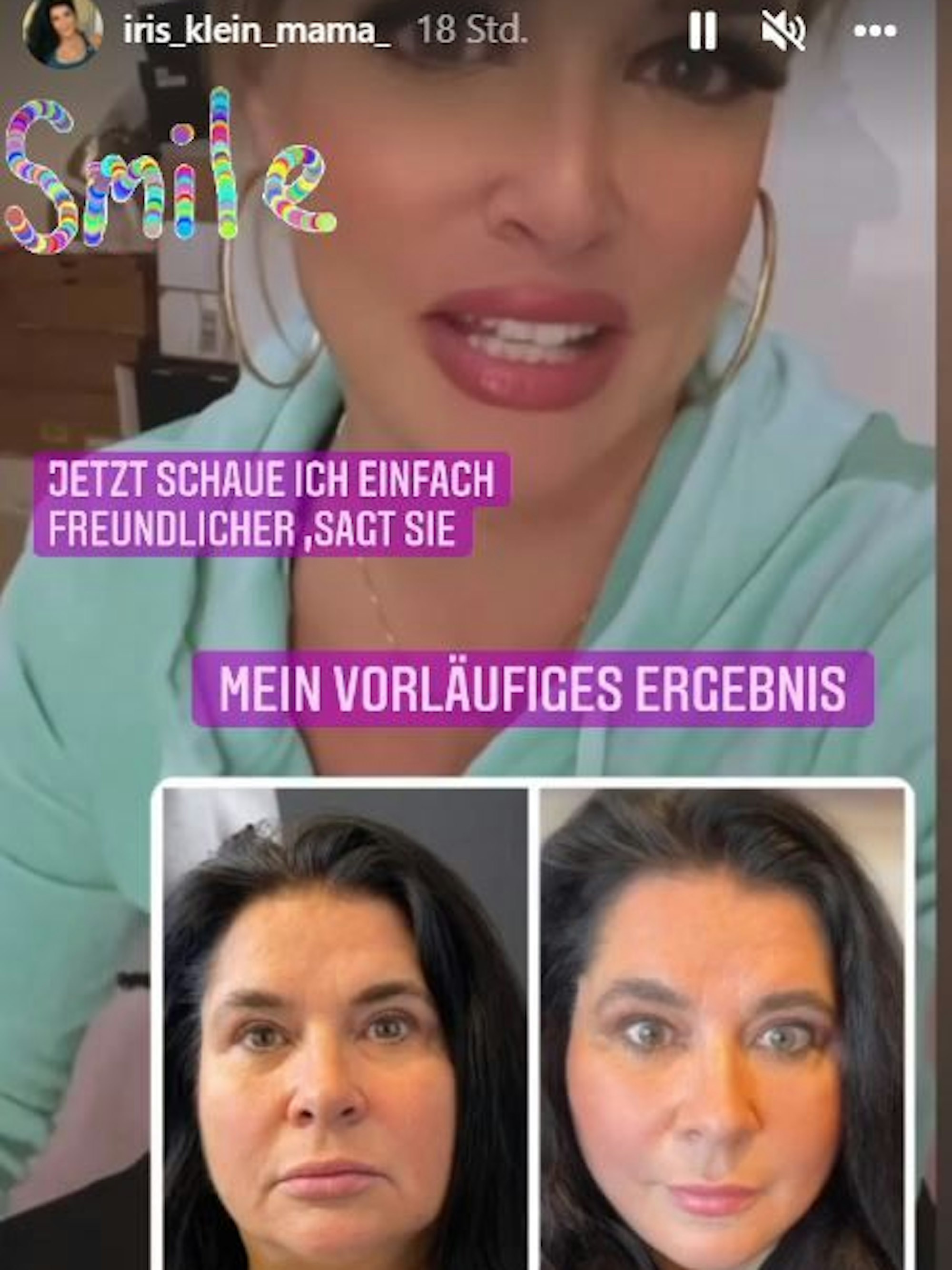 Iris Klein zeigt das Ergebnis ihres Face-Lifts. Im Intergrund ein Foto von Tochter Daniela.