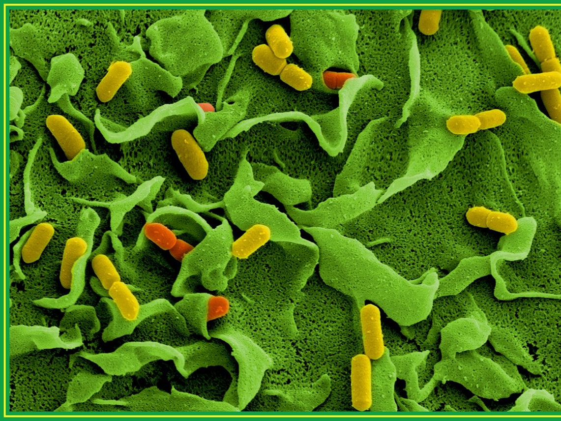 Elektronenmikroskopische Aufnahmen von Listerien vom Helmholtz-Zentrum für Infektionsforschung: Wegen einer möglichen Verunreinigung mit diesen Bakterien hat ein Hersteller seine Teewurst zurückgerufen.