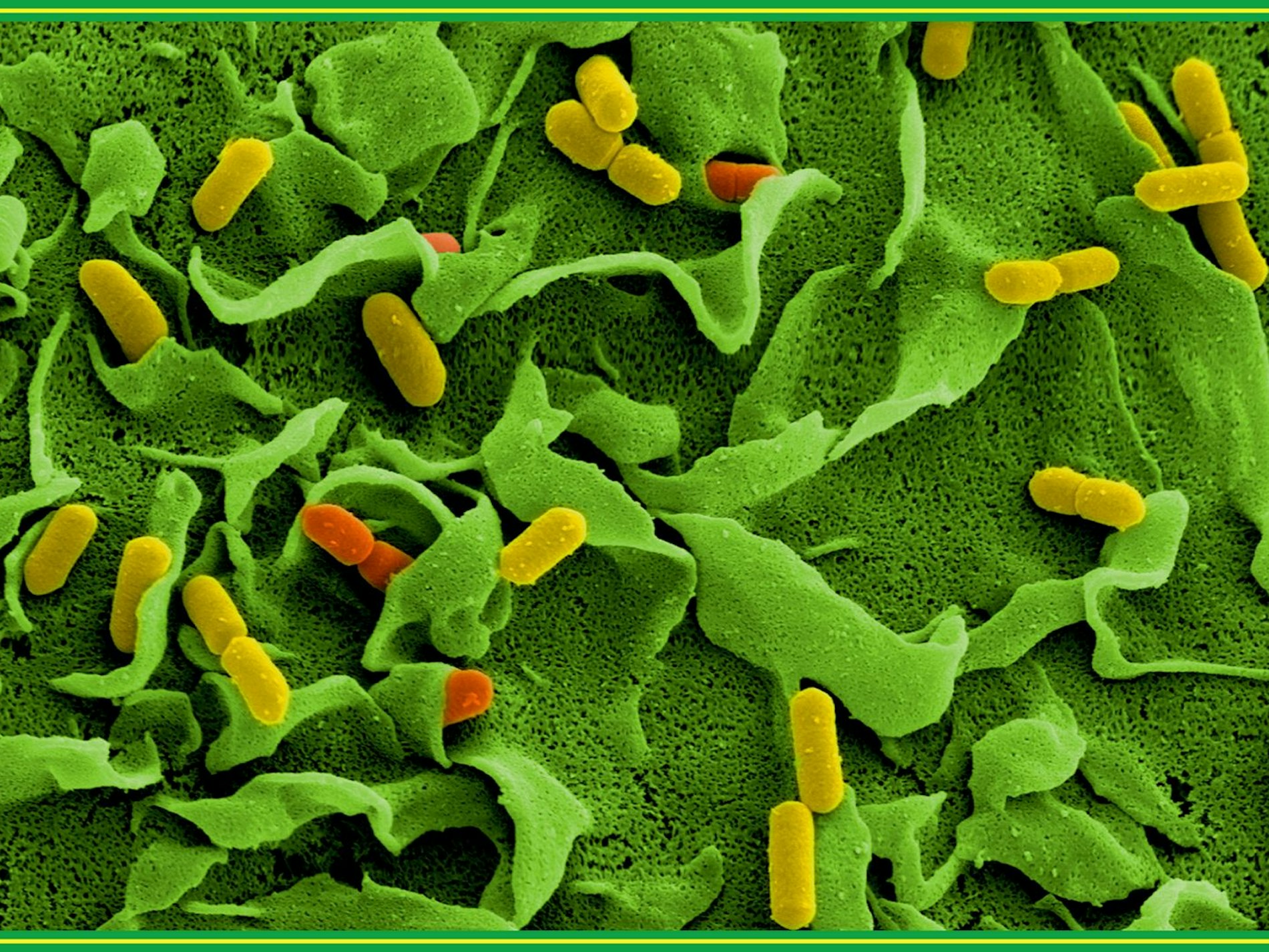 Elektronenmikroskopische Aufnahmen von Listerien vom Helmholtz-Zentrum für Infektionsforschung: Wegen einer möglichen Verunreinigung mit diesen Bakterien hat ein Hersteller seine Teewurst zurückgerufen.