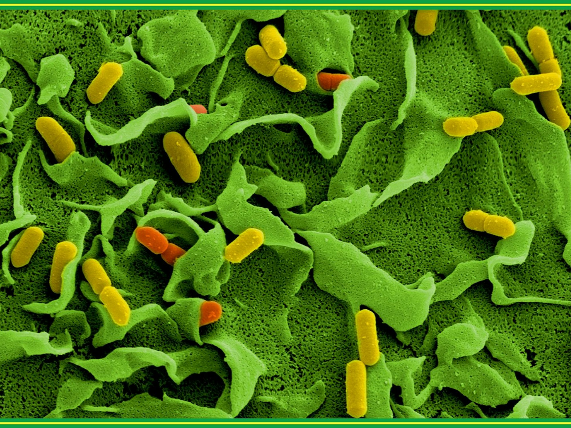 Elektronenmikroskopische Aufnahmen von Listerien vom Helmholtz-Zentrum für Infektionsforschung: Wegen einer möglichen Verunreinigung mit diesen Bakterien hat ein Hersteller seine Teewurst zurückgerufen.