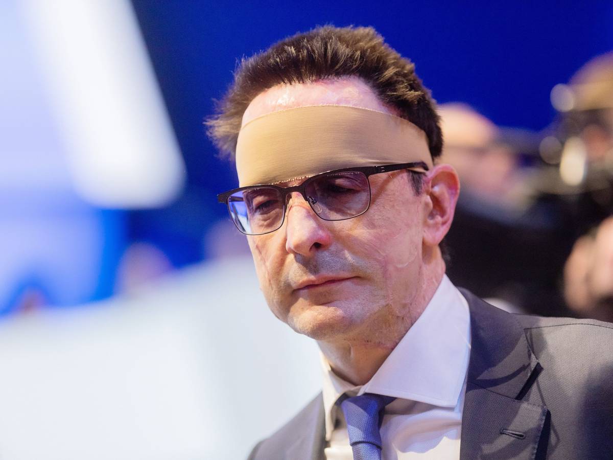 Bernhard Günther steht mit Verband um den Kopf in einem Raum.