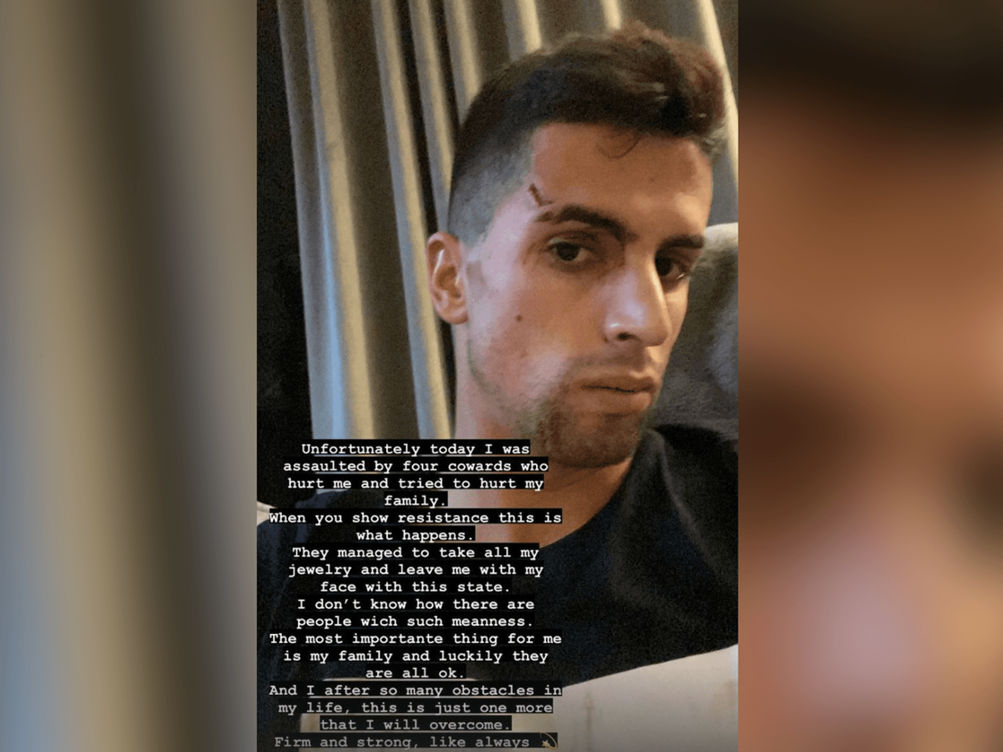 Fußball-Profi João Cancelo berichtet auf Instagram über den Überfall und zeigt sein zerkratztes Gesicht.