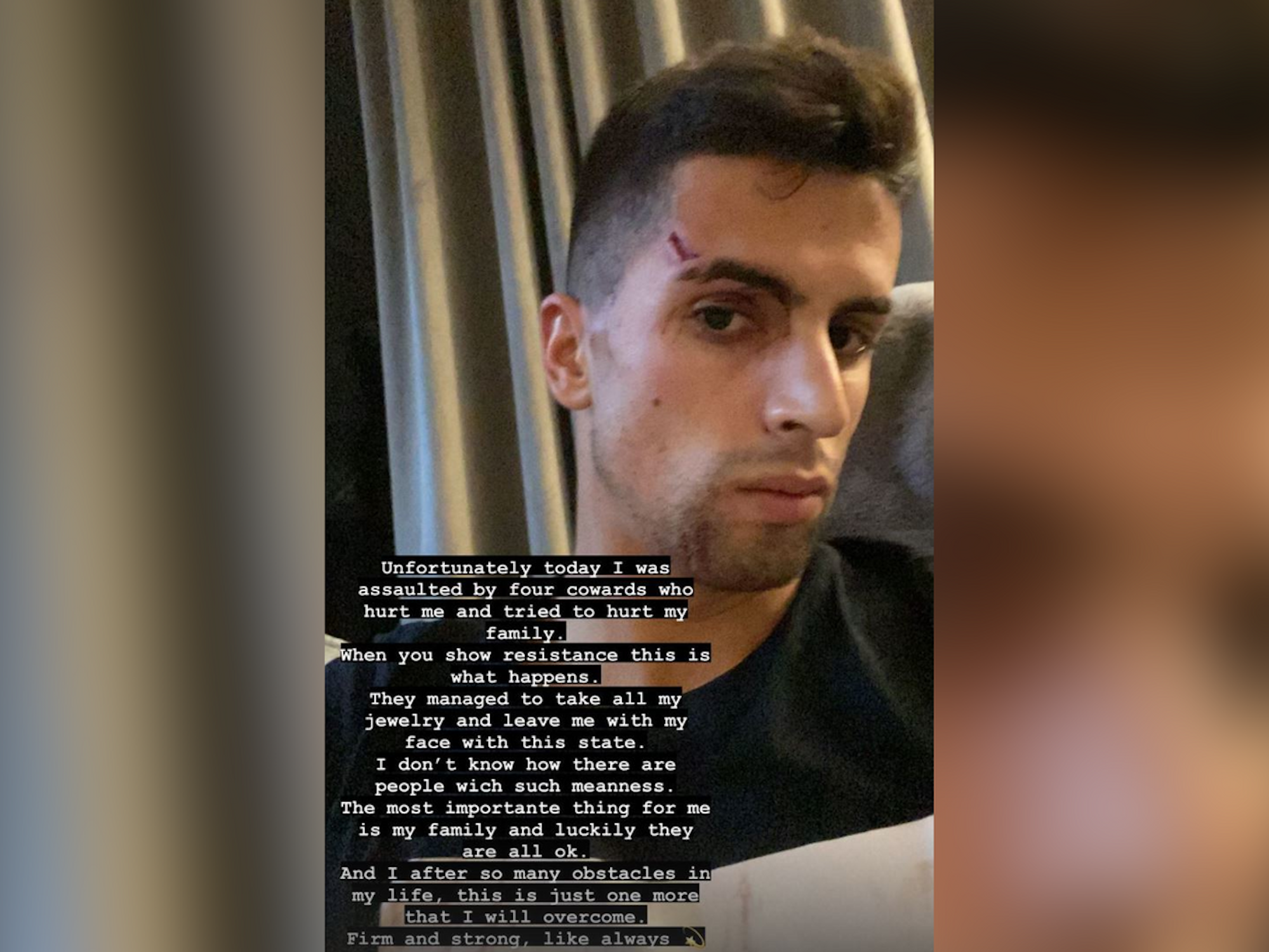 Fußball-Profi João Cancelo berichtet auf Instagram über den Überfall und zeigt sein zerkratztes Gesicht.