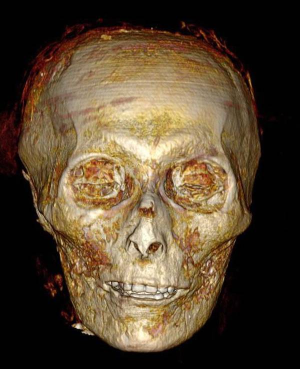 Dieses undatierte Foto zeigt einen CT-Scan des Amenhotep-Sarkophags. Der perfekt eingewickelte mumifizierte Körper des ägyptischen Pharaos Amenhotep I. wird zum ersten Mal seit Jahrhunderten ausgestellt, nachdem er mit Hightech-Scannern im Ägyptischen Museum in Kairo digital «ausgepackt» wurde. +++ dpa-Bildfunk +++