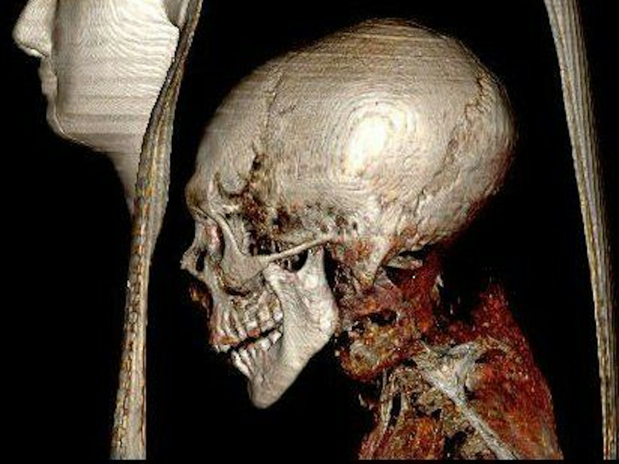 Dieses undatierte Foto zeigt den CT-Scan des Amenhotep-Sarkophags. Der perfekt eingewickelte mumifizierte Körper des ägyptischen Pharaos Amenhotep I. wird zum ersten Mal seit Jahrhunderten ausgestellt, nachdem er mit Hightech-Scannern im Ägyptischen Museum in Kairo digital «ausgepackt» wurde. +++ dpa-Bildfunk +++