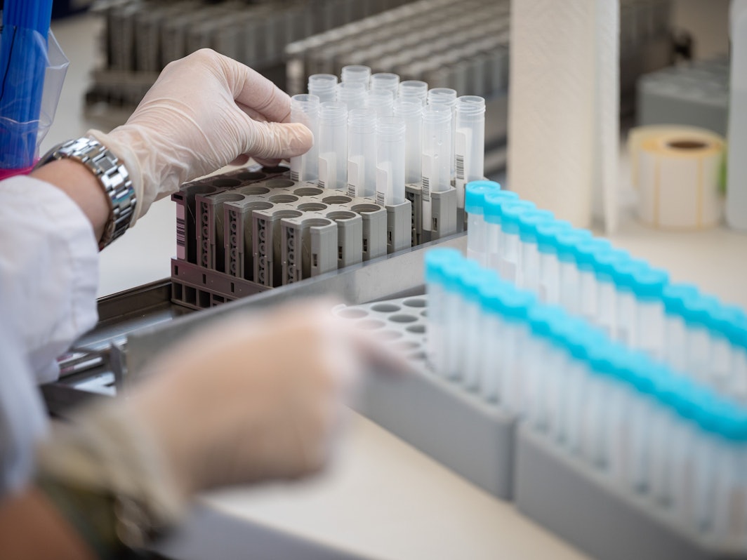 Eine Labormitarbeiterin bereitet im Labor in Mittelhessen Teströhrchen für einen PCR-Test vor. Die WHO warnt vor der Entstehung noch gefährlicherer Virusvarianten.