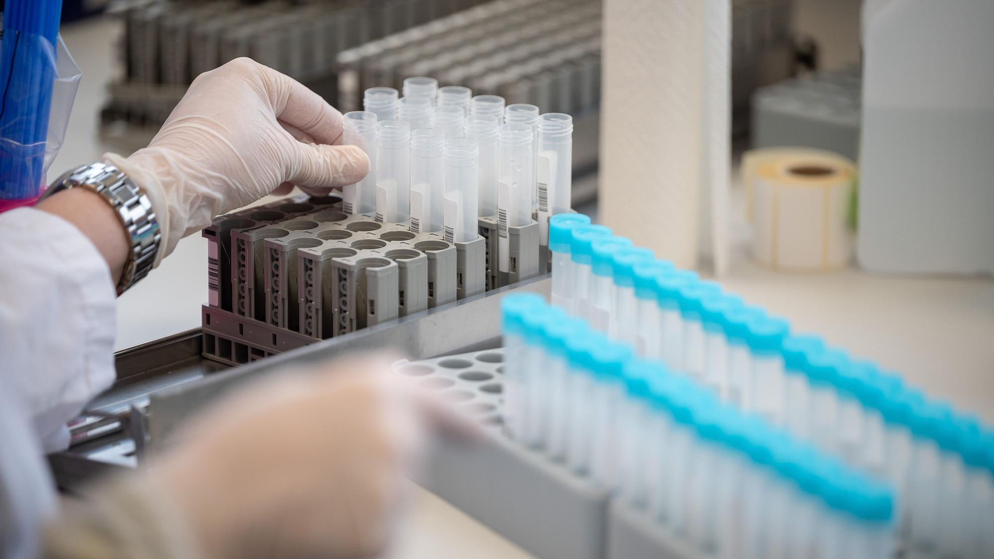 Eine Labormitarbeiterin bereitet im Labor in Mittelhessen Teströhrchen für einen PCR-Test vor. Die WHO warnt vor der Entstehung noch gefährlicherer Virusvarianten.