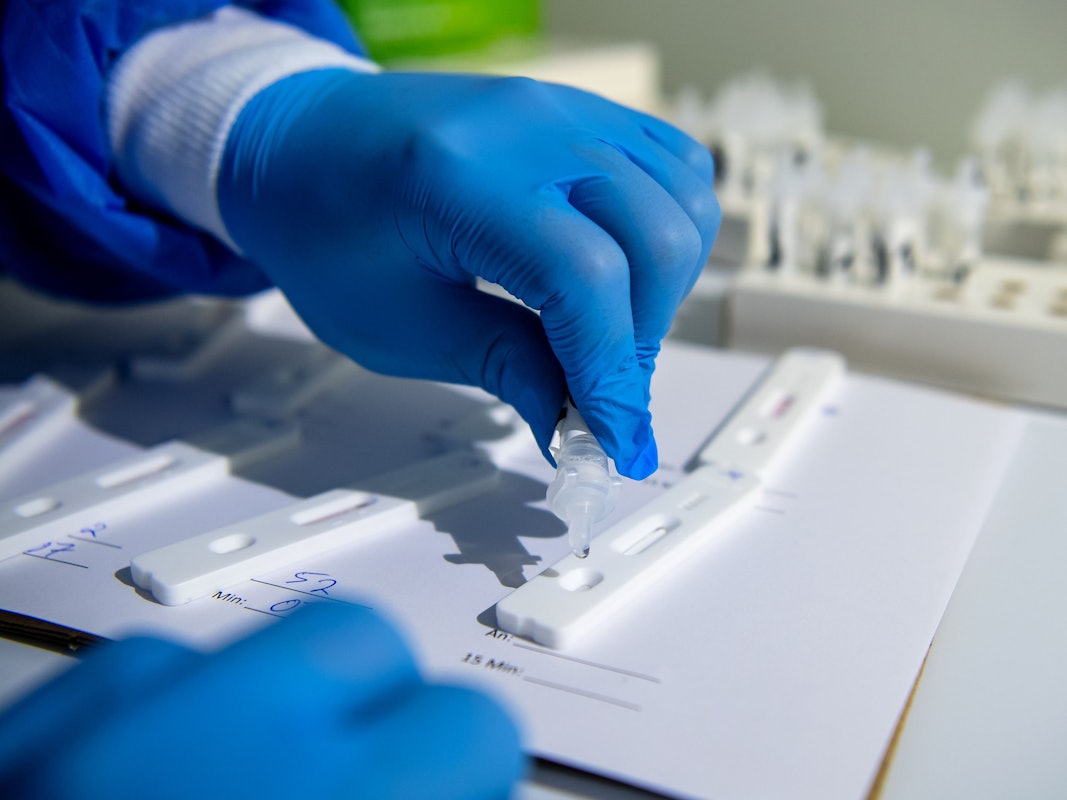 In einem Testzentrum werden Corona-Schnelltest ausgewertet.