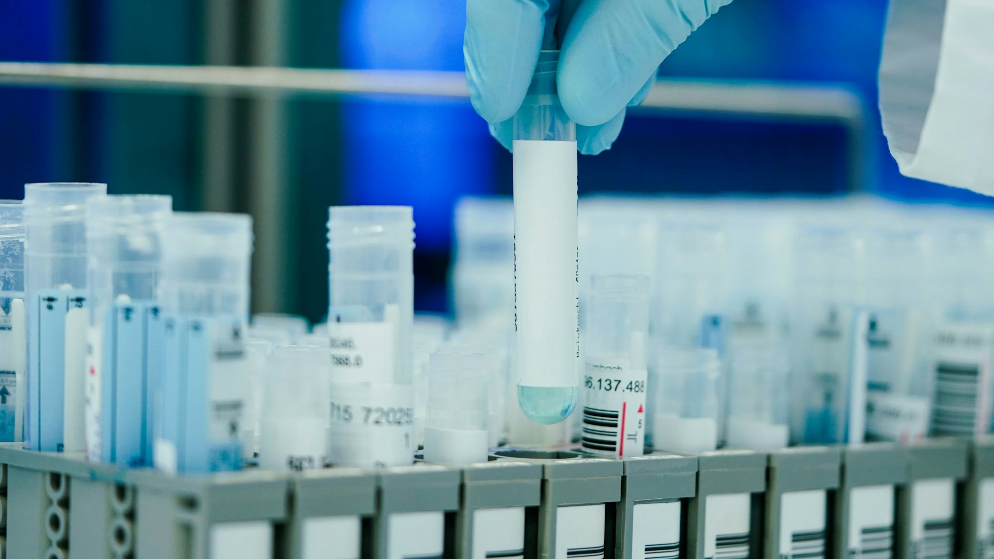 Das Symbolbild zeigt ein Testlabor, welches Corona-Tests auswertet. Das Foto ist am 13. Januar 2022 aufgenommen.