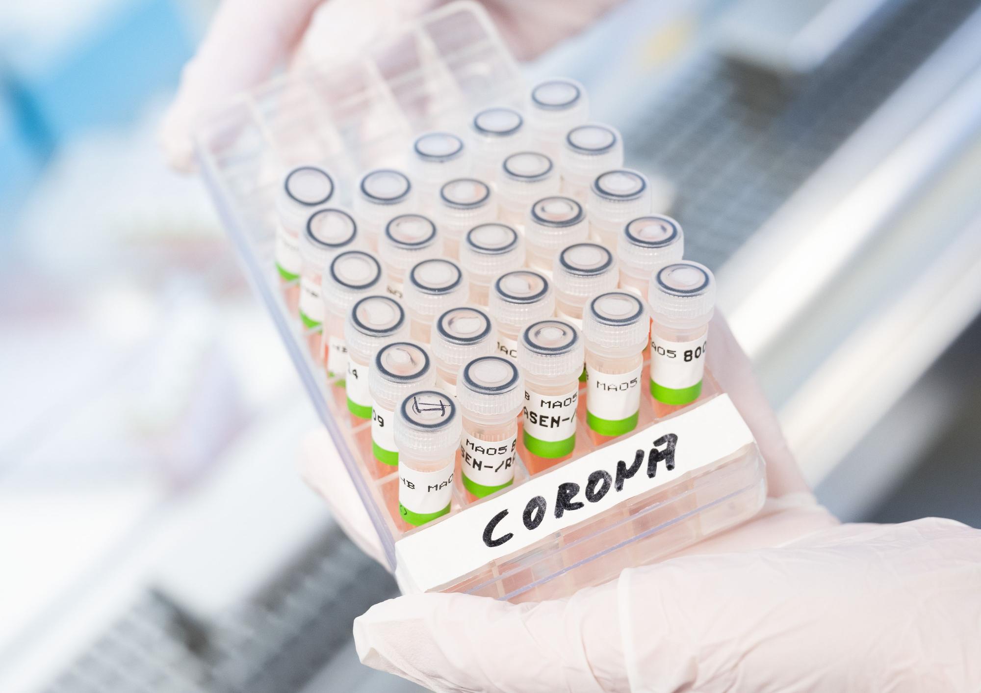 Das Symbolbild zeigt aufbereitete PCR-Tests auf das Corona-Virus im Labor am 5. Januar 2022.