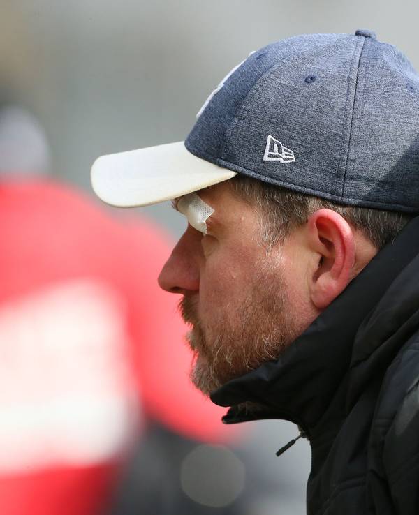 Trainer Steffen Baumgart zeigte sich beim Training am Donnerstag mit einem Pflaster über dem Auge