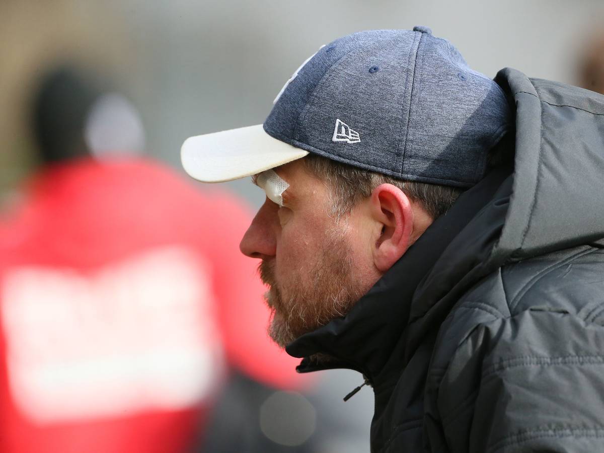 Trainer Steffen Baumgart zeigte sich beim Training am Donnerstag mit einem Pflaster über dem Auge