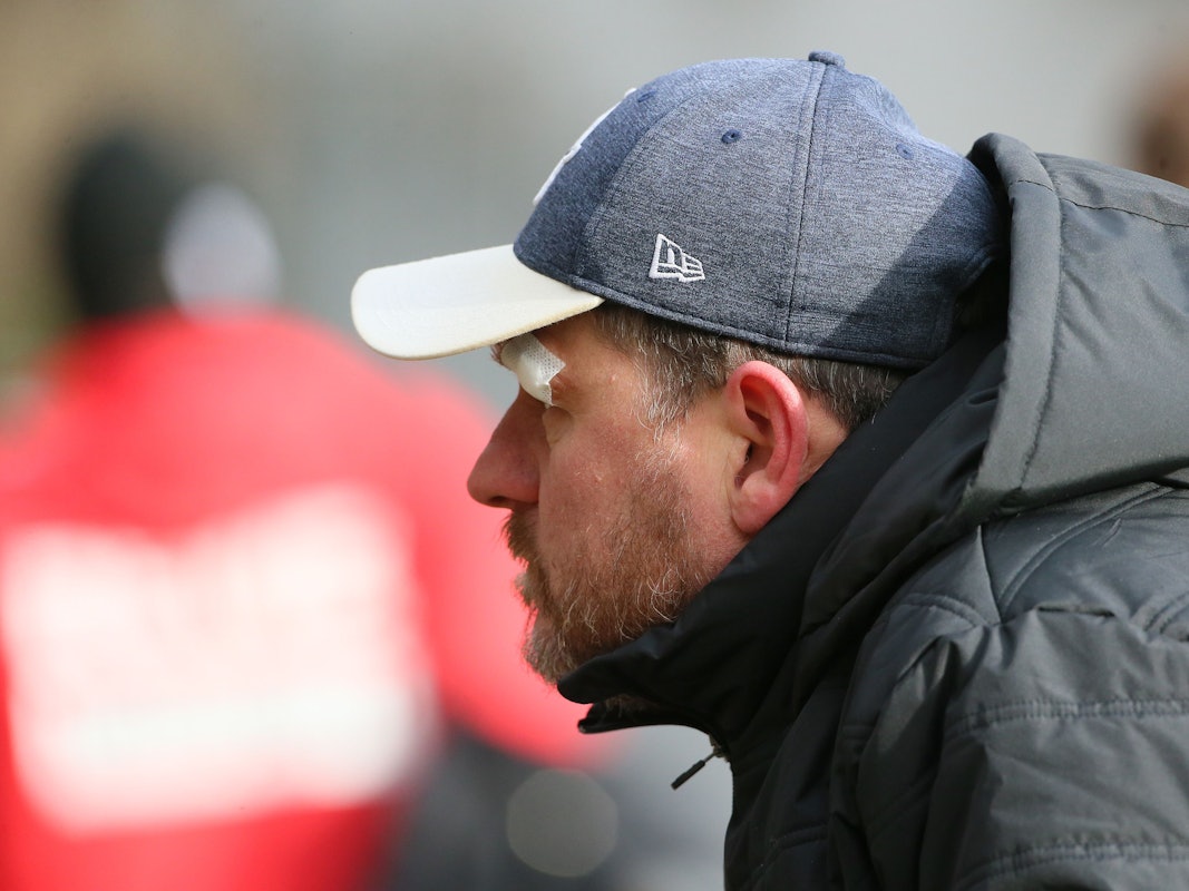 Trainer Steffen Baumgart zeigte sich beim Training am Donnerstag mit einem Pflaster über dem Auge