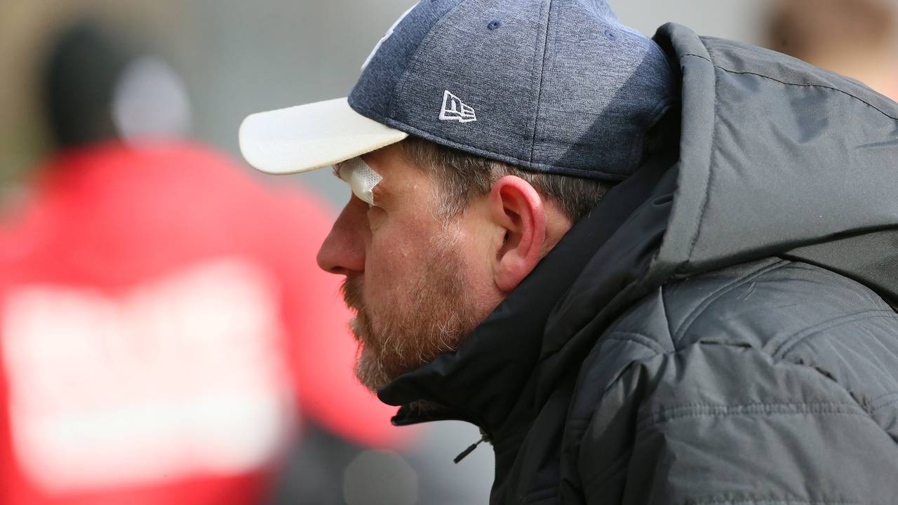 Trainer Steffen Baumgart zeigte sich beim Training am Donnerstag mit einem Pflaster über dem Auge