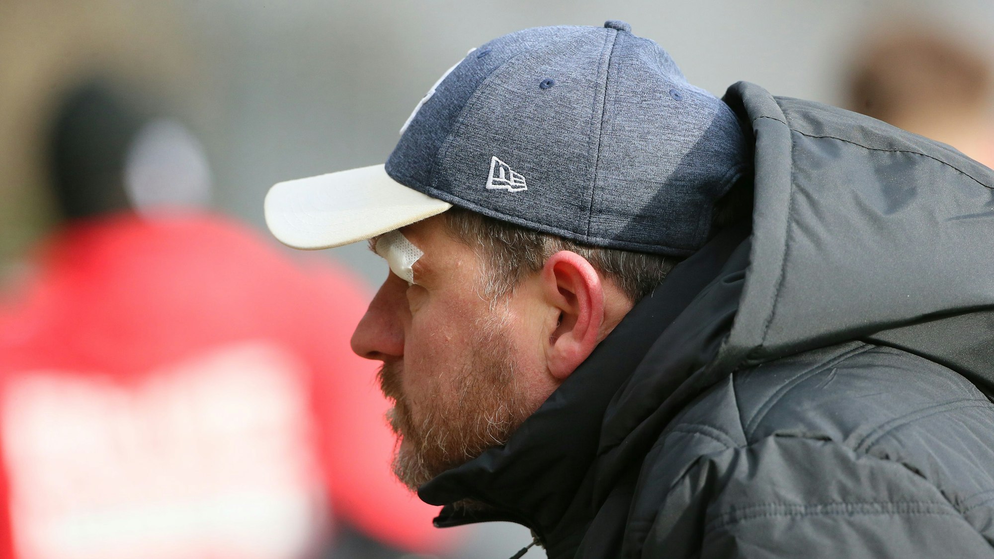 Trainer Steffen Baumgart zeigte sich beim Training am Donnerstag mit einem Pflaster über dem Auge