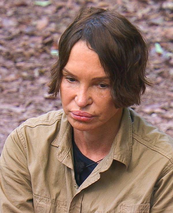 Anouschka Renzi, jetzt die letzte Frau im Dschungelcamp, nutzte das Lagerfeuer als Toilette und sorgte damit für jede Menge Zoff.