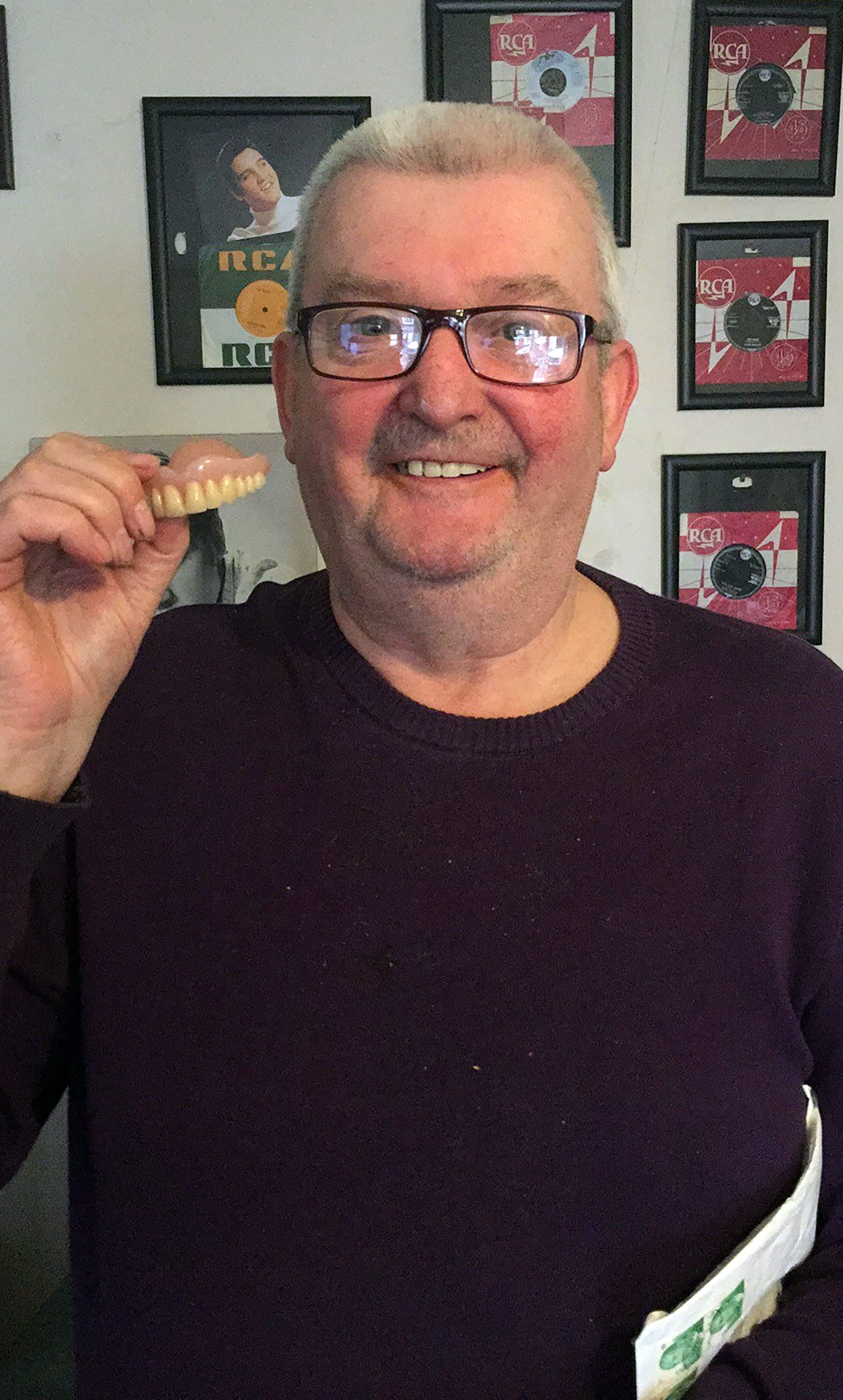 Paul Bishop zeigt das damals verloren gegangene Gebiss.